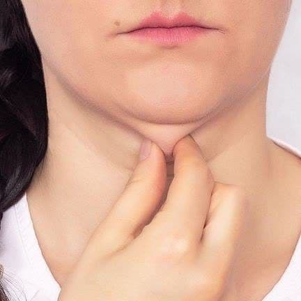 غبغب چیست ؟