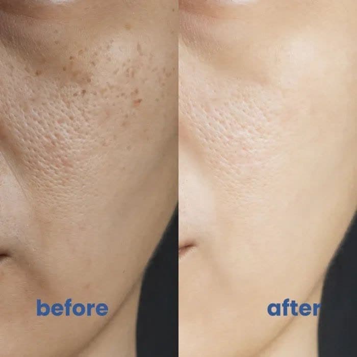 نحوه کار PSR چگونه است؟